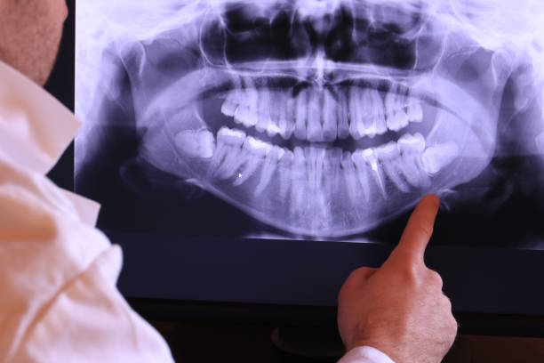 Best Tooth Infection Emergency Dentist  in Fairview, UT